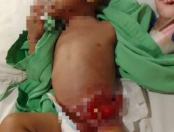 Aidil Perlu Uluran Tangan Para Donatur